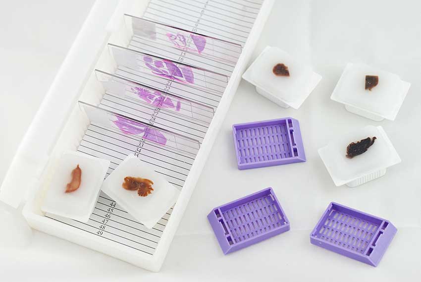 Tissue-processing-protocol
