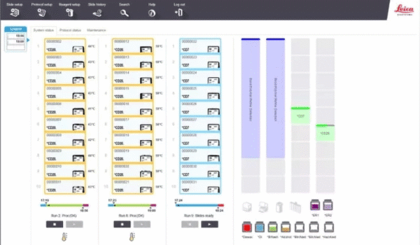 bond-max-interface bond-max-interface
