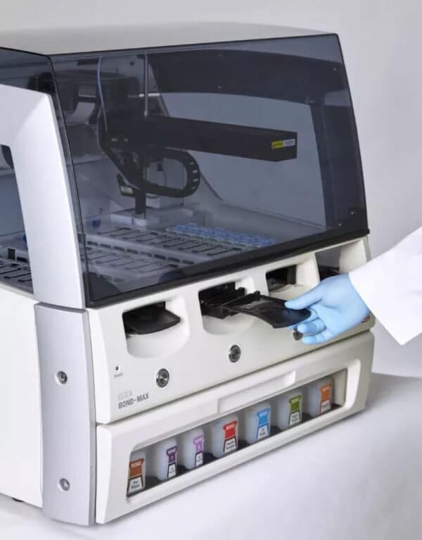 bond-max-loading bond-max-loading